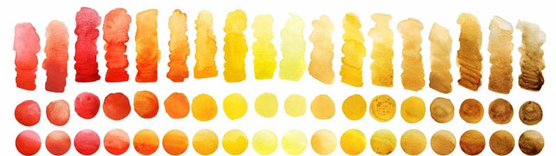 When Urine Isn’t Yellow: A Color-Coded Guide to Causes